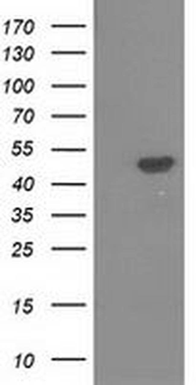 PACSIN3 Antibody in Western Blot (WB)