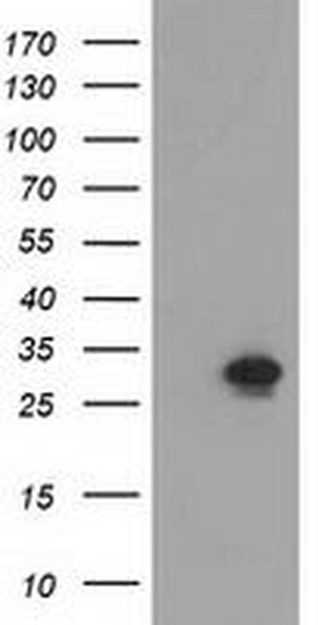 NMNAT1 Antibody in Western Blot (WB)