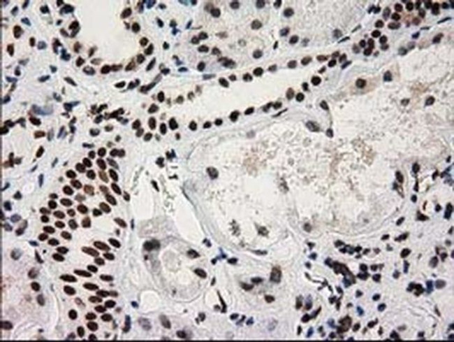 CTDSP1 Antibody in Immunohistochemistry (Paraffin) (IHC (P))