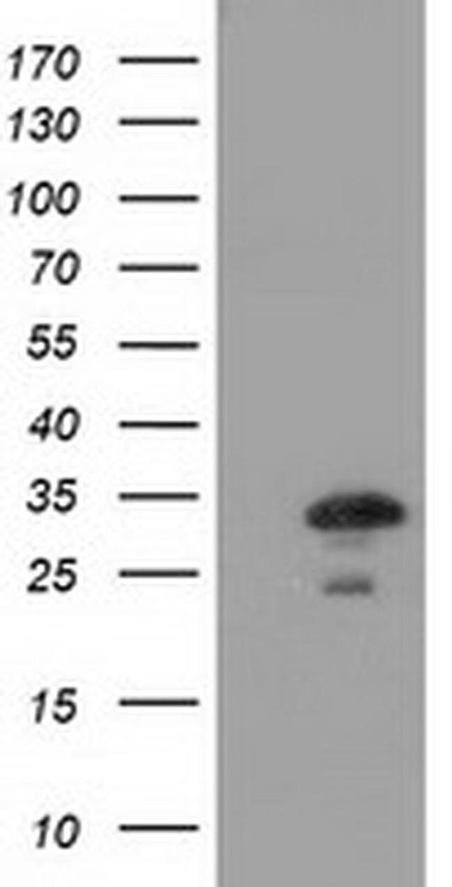 CTDSP1 Antibody in Western Blot (WB)