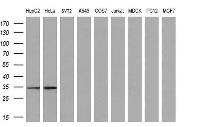 CTDSP1 Antibody in Western Blot (WB)