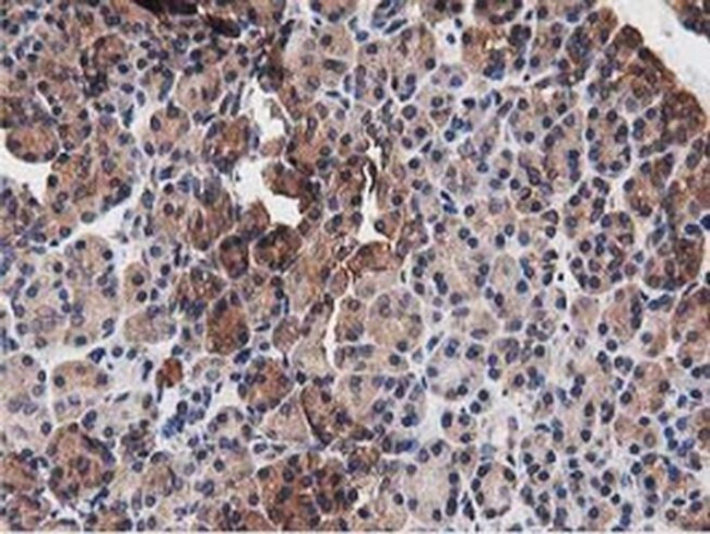 NUDT6 Antibody in Immunohistochemistry (Paraffin) (IHC (P))