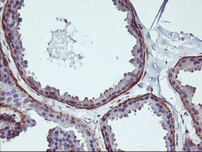 VASP Antibody in Immunohistochemistry (Paraffin) (IHC (P))