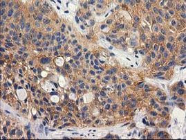 RTN4IP1 Antibody in Immunohistochemistry (Paraffin) (IHC (P))