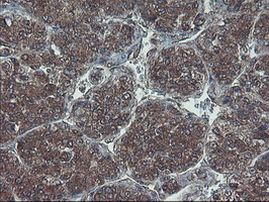 HDHD1 Antibody in Immunohistochemistry (Paraffin) (IHC (P))