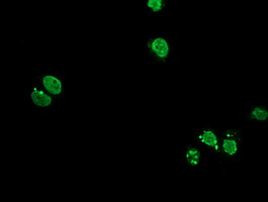 HOXC11 Antibody in Immunocytochemistry (ICC/IF)