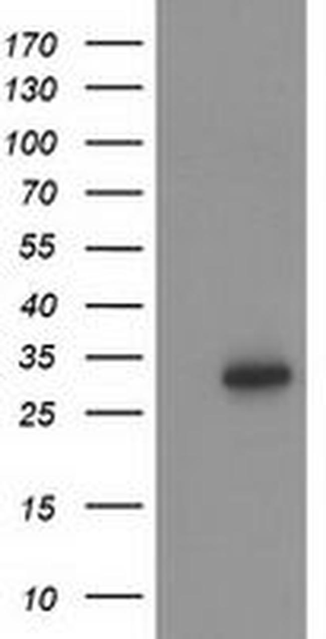 HOXC11 Antibody in Western Blot (WB)