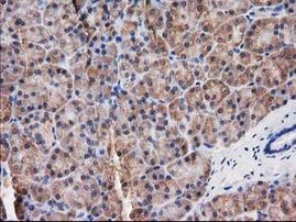 Destrin Antibody in Immunohistochemistry (Paraffin) (IHC (P))