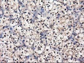 Destrin Antibody in Immunohistochemistry (Paraffin) (IHC (P))