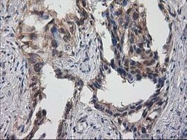 Destrin Antibody in Immunohistochemistry (Paraffin) (IHC (P))