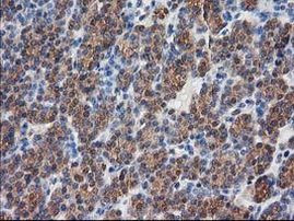 Destrin Antibody in Immunohistochemistry (Paraffin) (IHC (P))