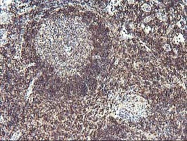 PDLIM2 Antibody in Immunohistochemistry (Paraffin) (IHC (P))