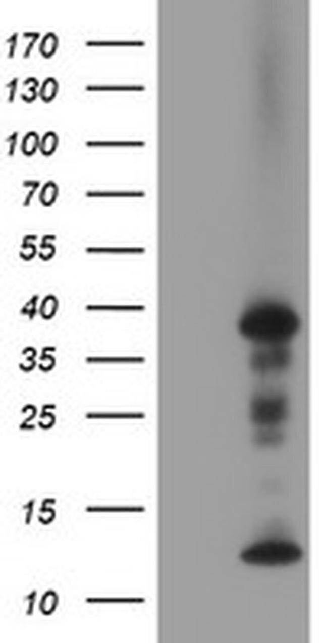 PDLIM2 Antibody in Western Blot (WB)