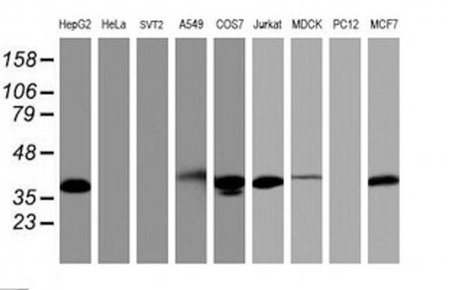 PDLIM2 Antibody in Western Blot (WB)