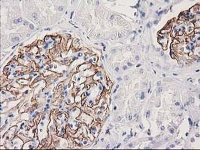 PDLIM2 Antibody in Immunohistochemistry (Paraffin) (IHC (P))