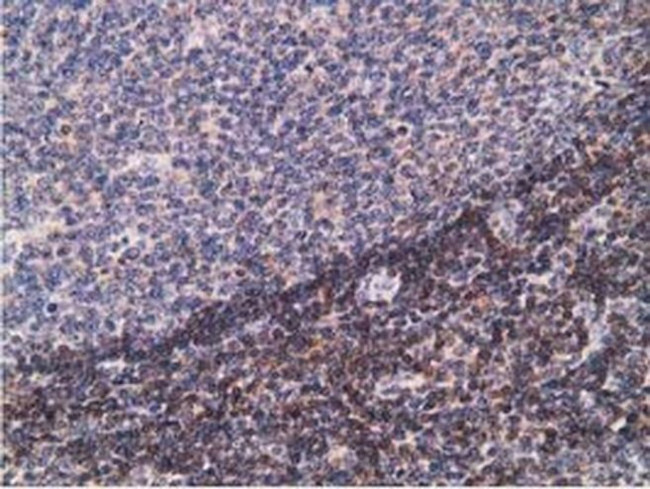 PDLIM2 Antibody in Immunohistochemistry (Paraffin) (IHC (P))