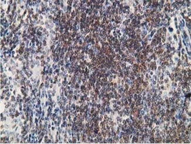 PDLIM2 Antibody in Immunohistochemistry (Paraffin) (IHC (P))