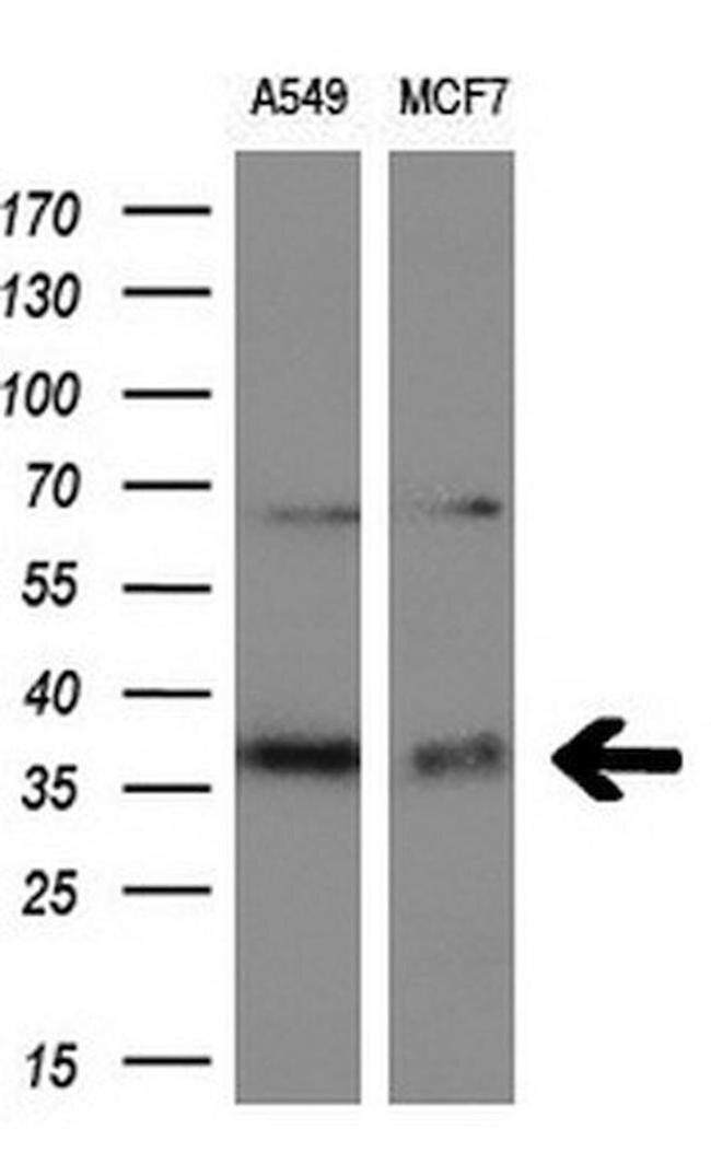 ITM2B Antibody in Western Blot (WB)
