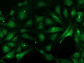 PNMT Antibody in Immunocytochemistry (ICC/IF)