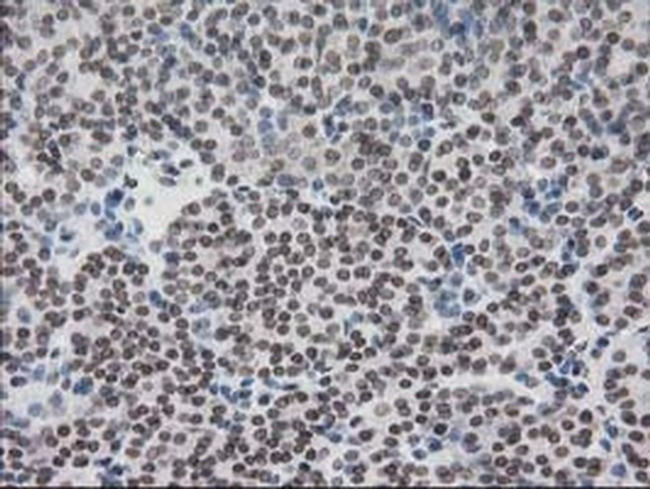 CRY2 Antibody in Immunohistochemistry (Paraffin) (IHC (P))