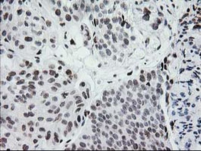 CRY2 Antibody in Immunohistochemistry (Paraffin) (IHC (P))