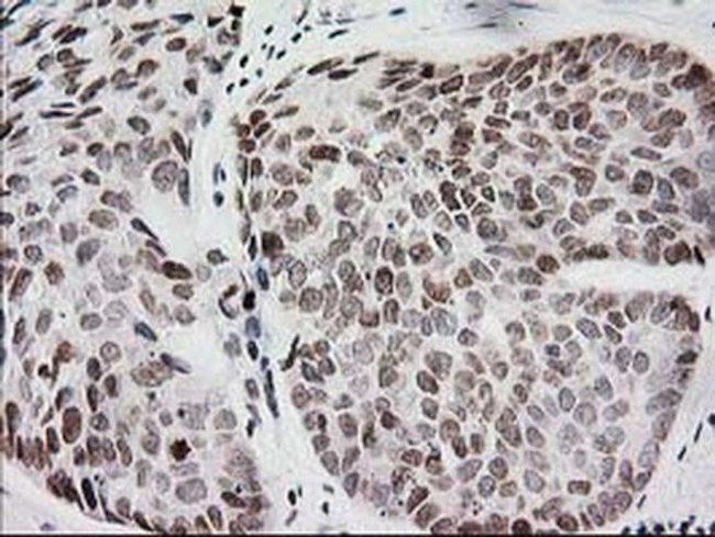 CRY2 Antibody in Immunohistochemistry (Paraffin) (IHC (P))