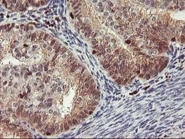 GRAP2 Antibody in Immunohistochemistry (Paraffin) (IHC (P))