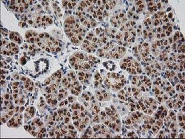 Monoacylglycerol Lipase Antibody in Immunohistochemistry (Paraffin) (IHC (P))