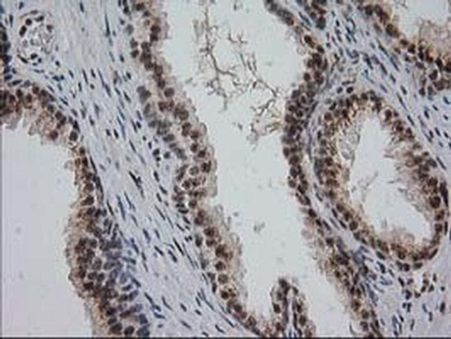 Monoacylglycerol Lipase Antibody in Immunohistochemistry (Paraffin) (IHC (P))