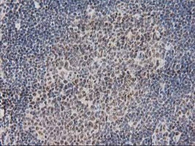 Monoacylglycerol Lipase Antibody in Immunohistochemistry (Paraffin) (IHC (P))