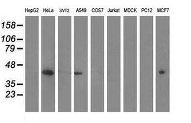 MVK Antibody in Western Blot (WB)