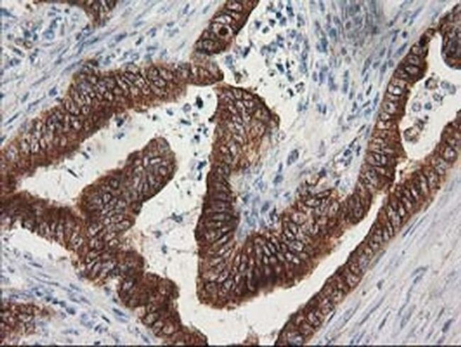 beta-4 Tubulin Antibody in Immunohistochemistry (Paraffin) (IHC (P))