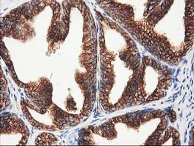 beta-4 Tubulin Antibody in Immunohistochemistry (Paraffin) (IHC (P))