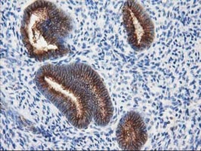 beta-4 Tubulin Antibody in Immunohistochemistry (Paraffin) (IHC (P))