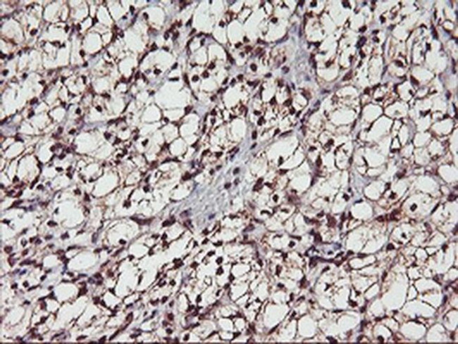 Monoacylglycerol Lipase Antibody in Immunohistochemistry (Paraffin) (IHC (P))