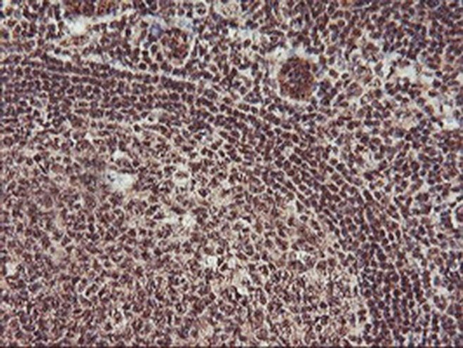 Monoacylglycerol Lipase Antibody in Immunohistochemistry (Paraffin) (IHC (P))