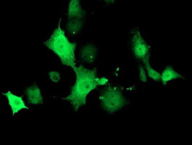 TMOD1 Antibody in Immunocytochemistry (ICC/IF)