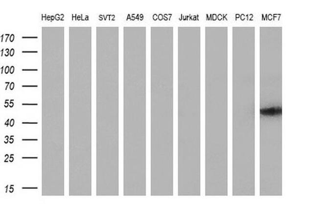 TMOD1 Antibody in Western Blot (WB)