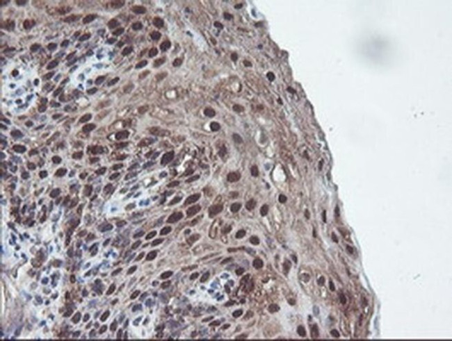 CBR3 Antibody in Immunohistochemistry (Paraffin) (IHC (P))