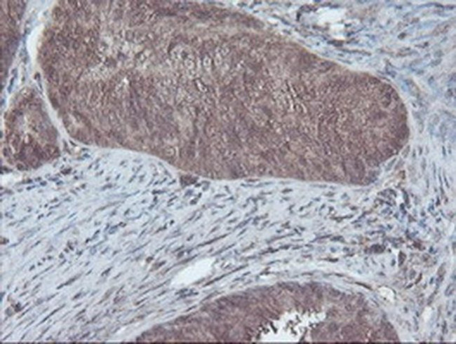 CBR3 Antibody in Immunohistochemistry (Paraffin) (IHC (P))