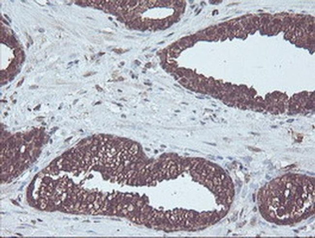 CBR3 Antibody in Immunohistochemistry (Paraffin) (IHC (P))