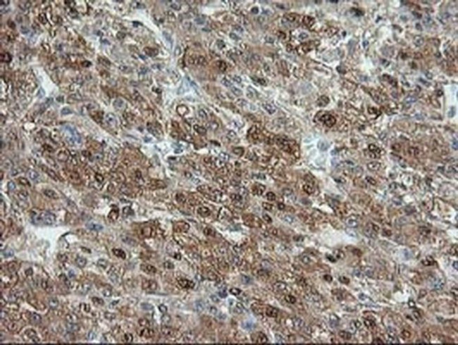 Aminoacylase Antibody in Immunohistochemistry (Paraffin) (IHC (P))