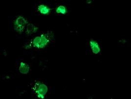 TRAP alpha Antibody in Immunocytochemistry (ICC/IF)