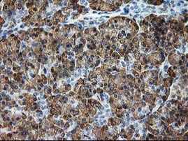 TRAP alpha Antibody in Immunohistochemistry (Paraffin) (IHC (P))