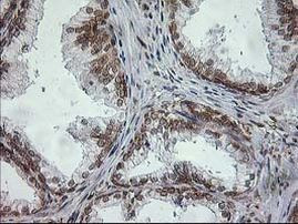 TRAP alpha Antibody in Immunohistochemistry (Paraffin) (IHC (P))