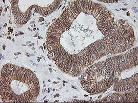 TRAP alpha Antibody in Immunohistochemistry (Paraffin) (IHC (P))