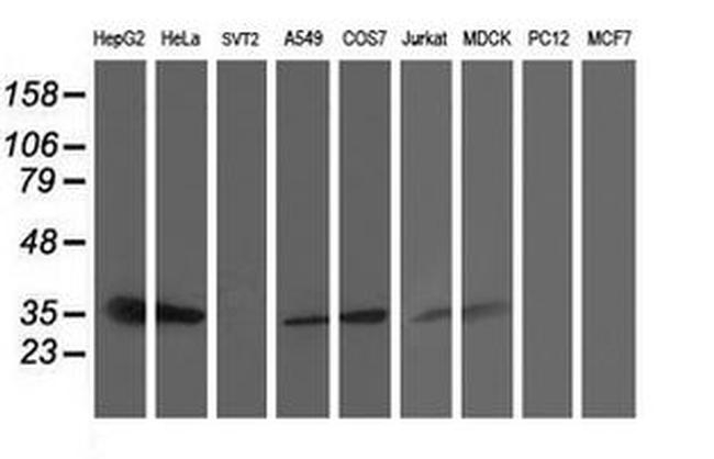 TRAP alpha Antibody in Western Blot (WB)