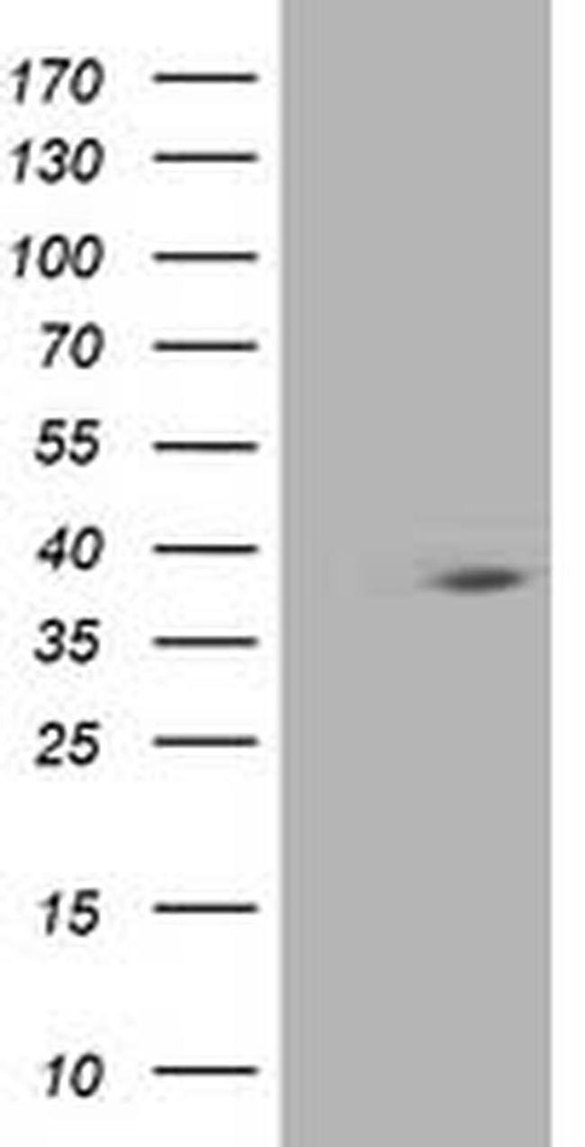 HSPBP1 Antibody in Western Blot (WB)