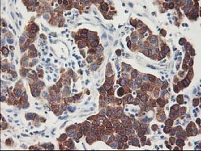 FDFT1 Antibody in Immunohistochemistry (Paraffin) (IHC (P))