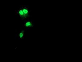 RAD51B Antibody in Immunocytochemistry (ICC/IF)